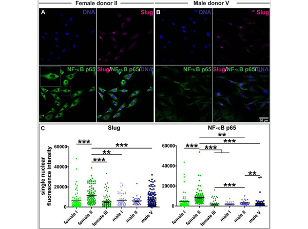 Immunofluorescence using NFKBp65