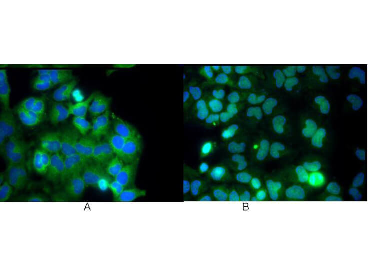 Anti-NFKB p65 (Rel A) Antibody - Immunofluorescence Microscopy