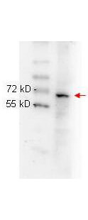 Anti-NFKB p65 (Rel A) Antibody - Western Blot