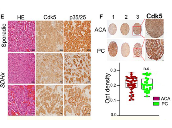 Immunohistochemistry using CDK5