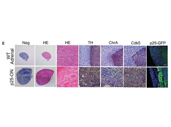 Immunohistochemistry using CDK5