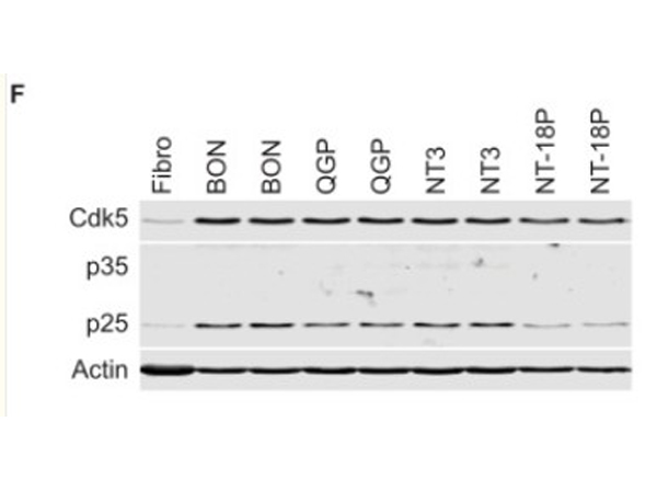 Western blot using CDK5