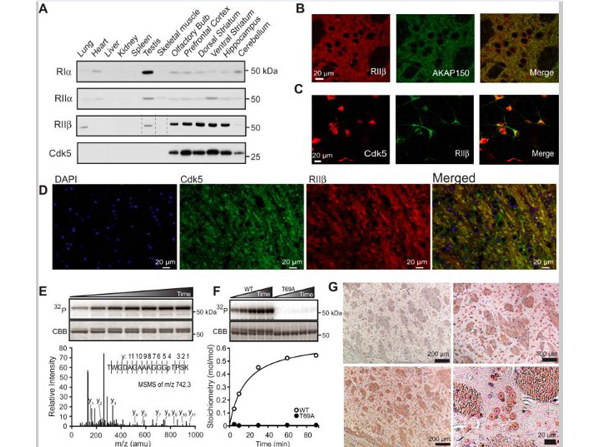 Western blot and Immunofluorescence using CDK5