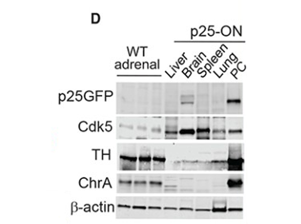 Western blot using CDK5