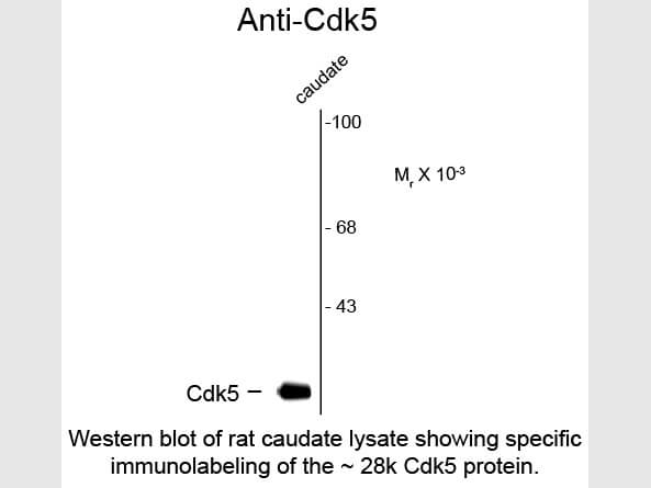 Western Blot of Anti-CDK5 (Mouse) Antibody - 200-301-163