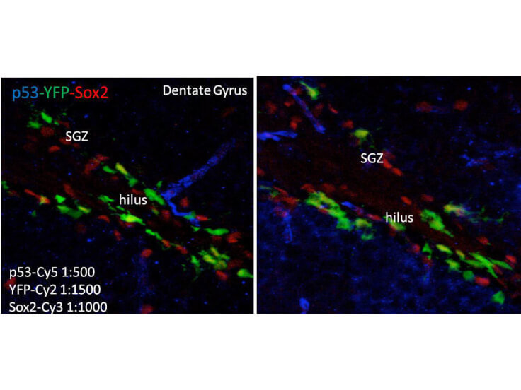 Immunofluorescence - Mouse anti-p53
