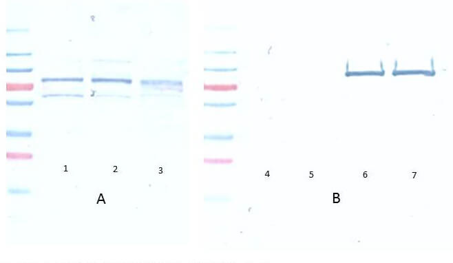 AKT pS473 Monoclonal Antibody - Western Blot