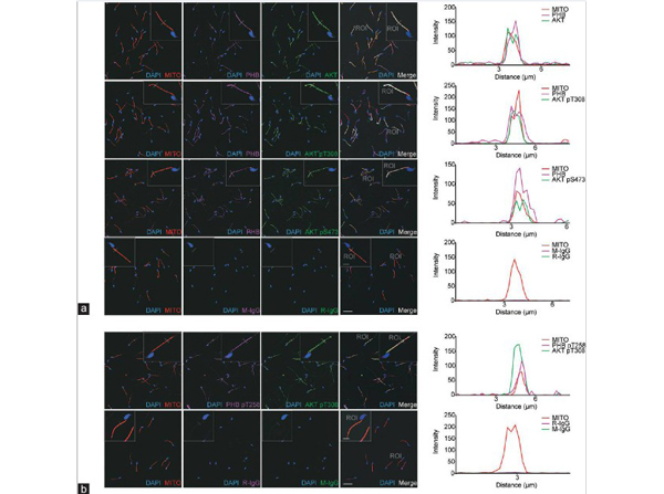 Immunofluorescence using AKTpT308