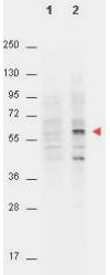 Anti-AKT pT308 Monoclonal Antibody - Western Blot