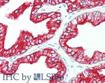 Immunohistochemistry of Mouse anti-Keratin antibody