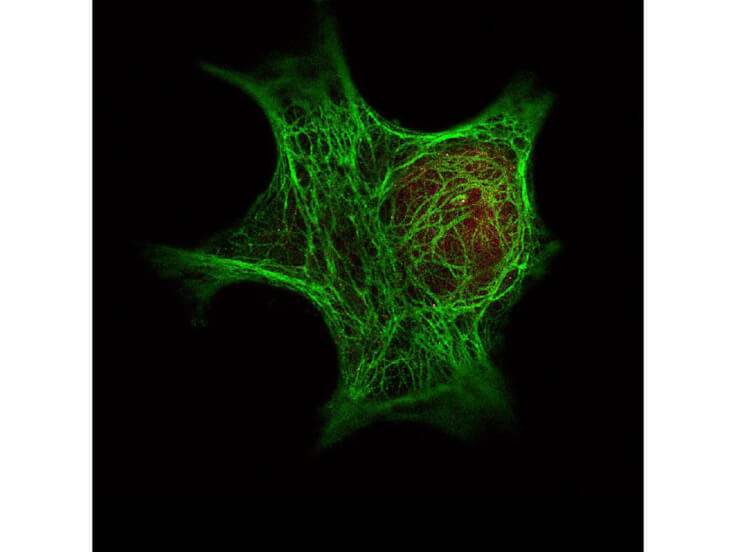 Immunofluorescence Microscopy- Anti-Keratin Antibody