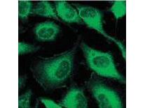 Immunofluorescence Microscopy - Anti-Keratin monoclonal antibody