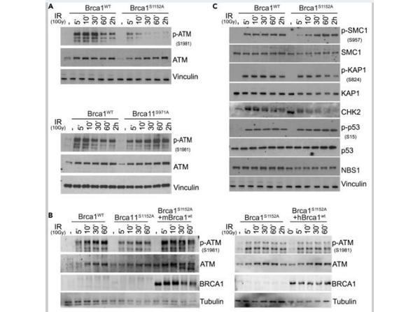 Western Blot using ATMpS1981