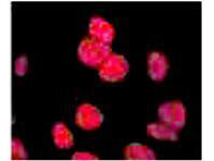 Anti-ATM Monoclonal Antibody - Immunofluorescence Microscopy