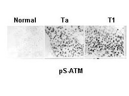 ATM phospho S1981 Antibody