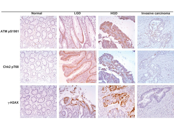 Immunohistochemistry using ATMpS1981