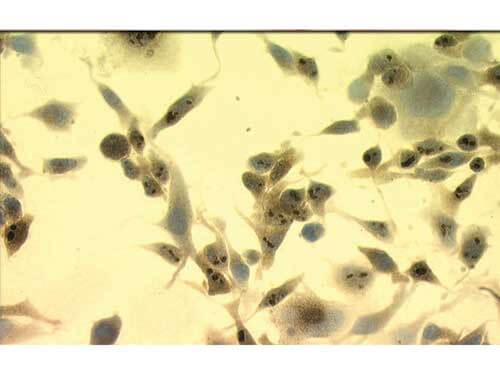 Hsp70 Mouse Melanoma Cells