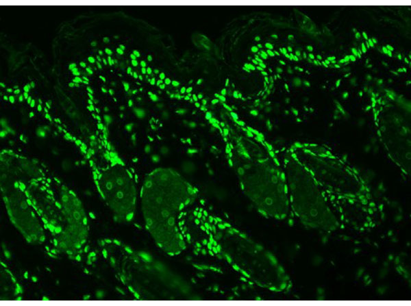 Immunohistochemistry of Mouse Anti-Acetylated Lysine