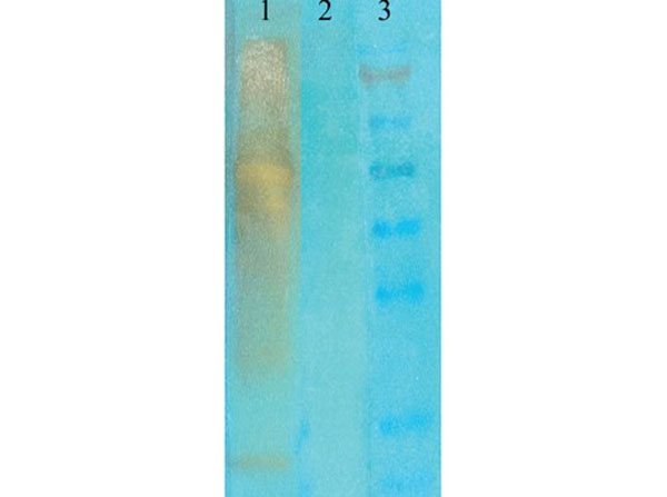 Western Blot analysis of Mouse Anti-Acetylated Lysine