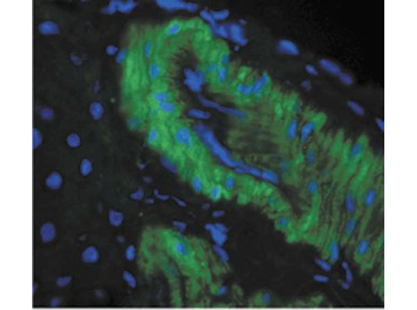 Immunohistochemistry of Mouse Anti-Nitrotyrosine
