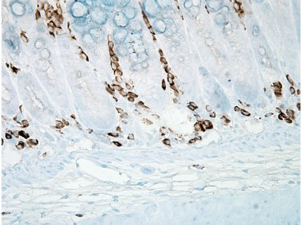 Immunohistochemistry of Mouse Anti-Nitrotyrosine