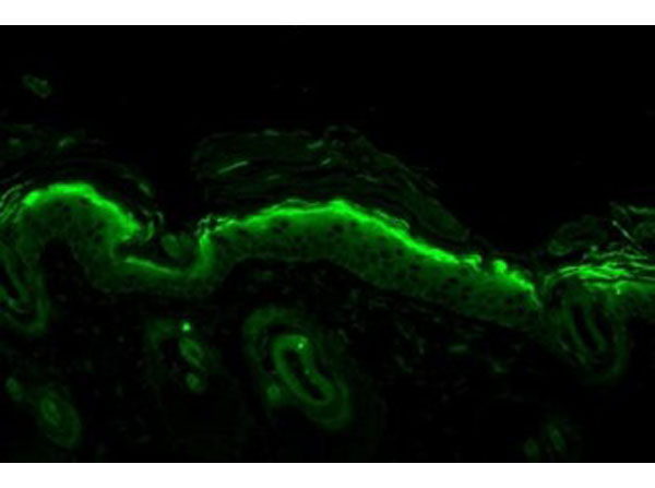 Immunohistochemistry of Mouse Anti-Nitrotyrosine