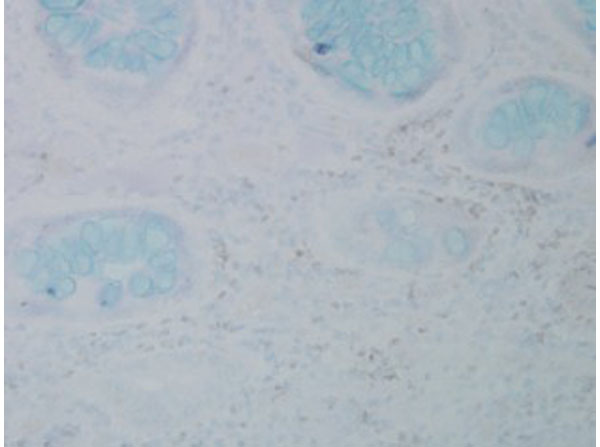 Immunohistochemistry of Mouse Anti-Nitrotyrosine
