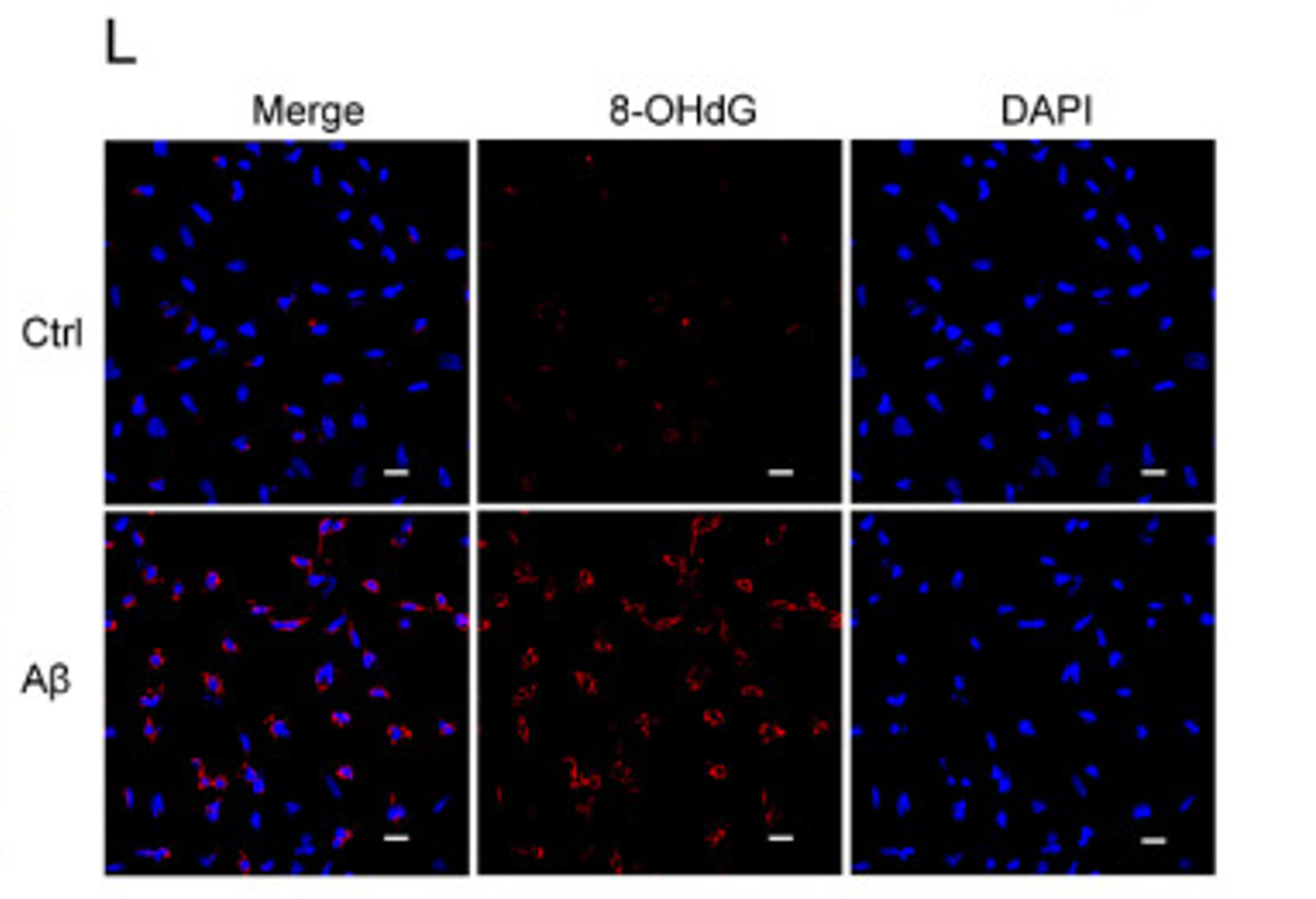 Immunofluorescence using 8OHdG