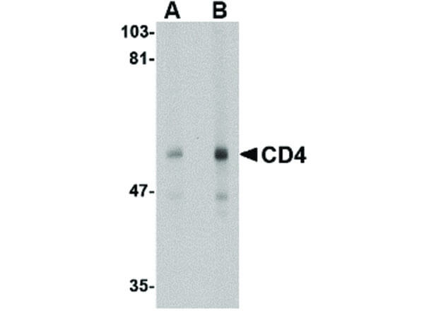 Western Blot of CD4 Antibody