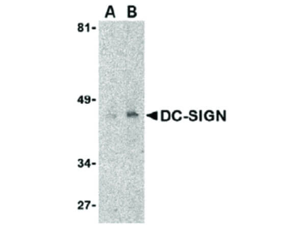Western Blot of DC-SIGN Antibody