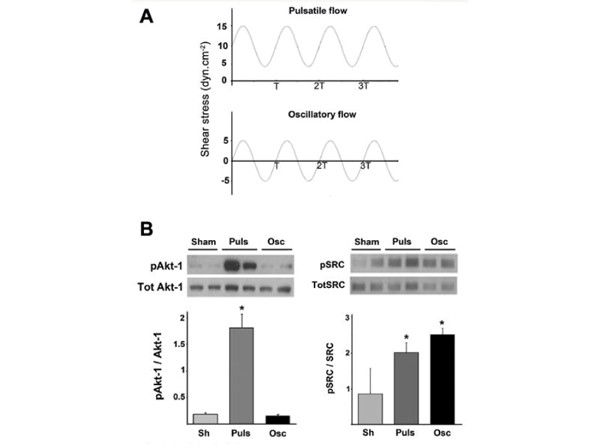 Western Blot using AKTpS473