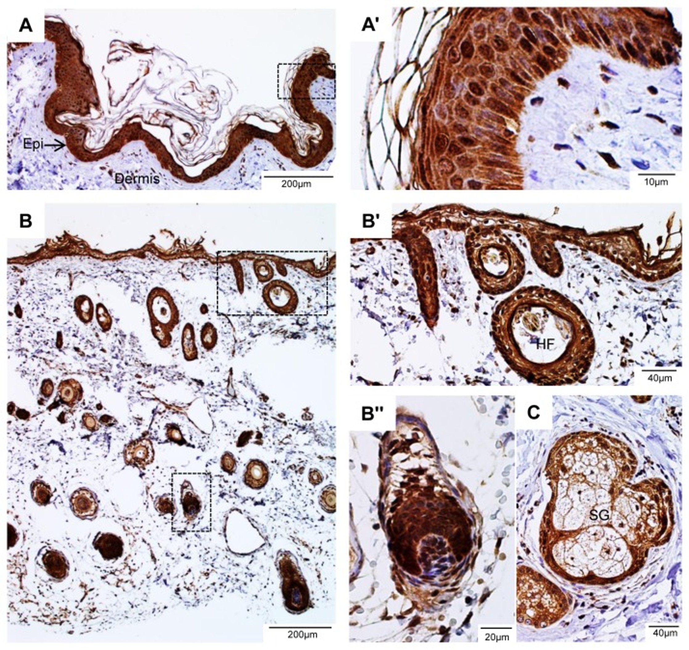 Immunohistochemistry using LGR4