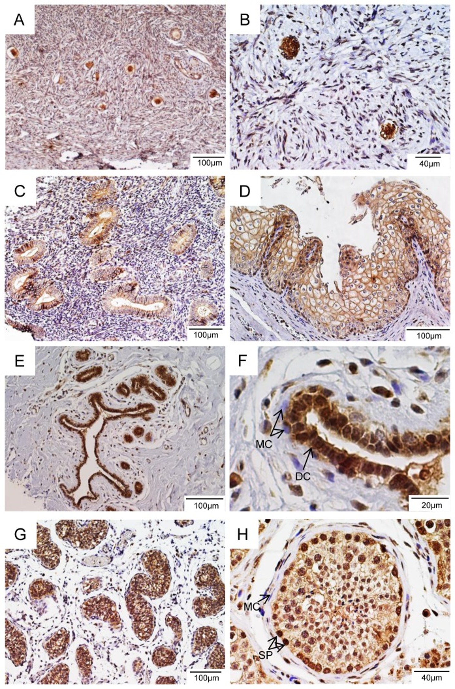 Immunohistochemistry using LGR4