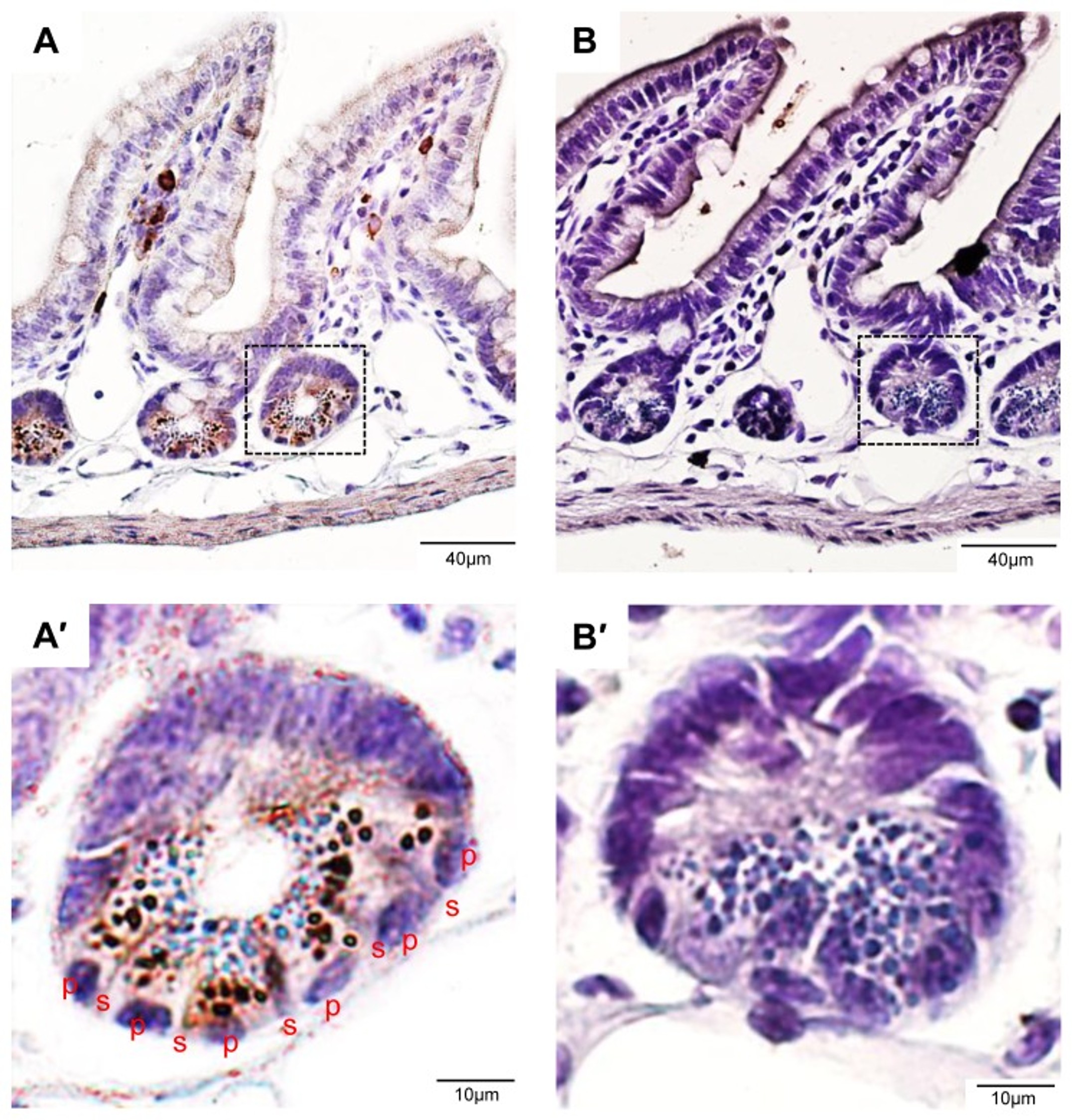 Immunohistochemistry using LGR4
