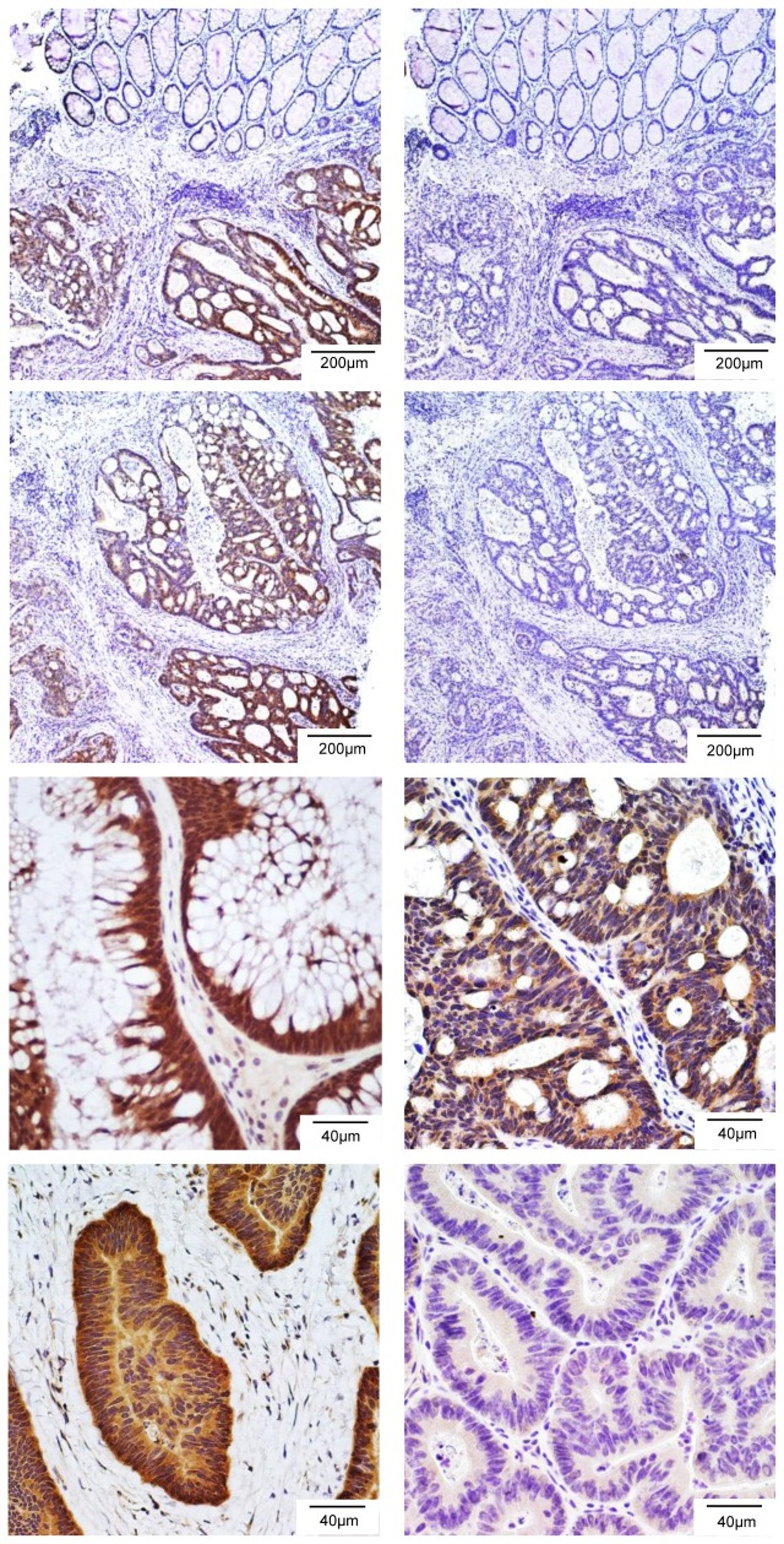 Immunohistochemistry using LGR4