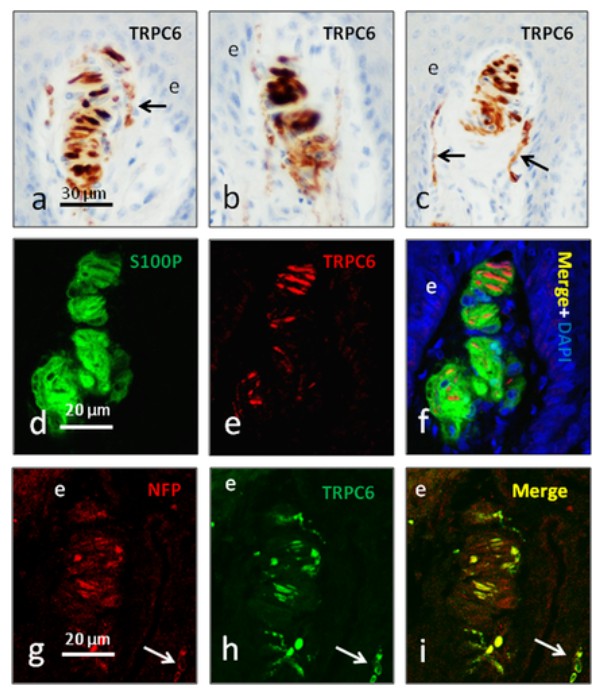 Immunofluorescence using TRPC6
