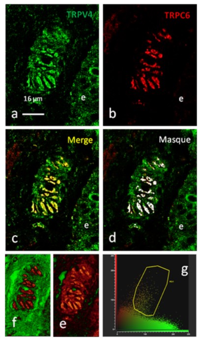 Immunofluorescence using TRPC6