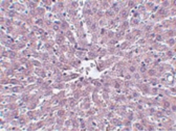 Immunohistochemistry of IRAK Antibody