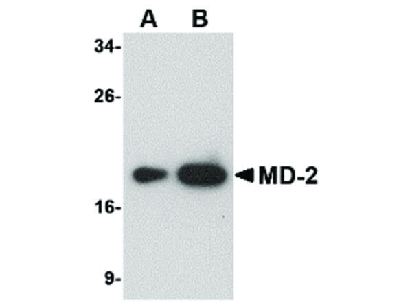 Western Blot of MD-2 Antibody