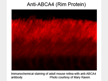 Western Blot of Anti-ABCA4 (Rim Protein) (Mouse) Antibody - 200-301-D05