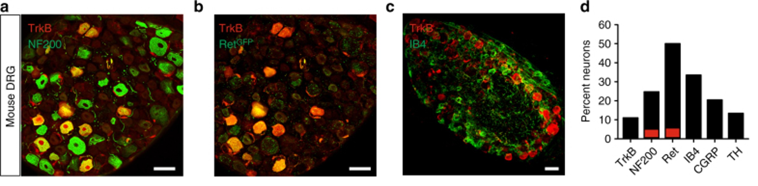 Immunofluorescence using CGRP