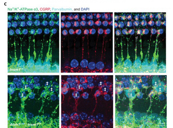 Immunofluorescence using CGRP