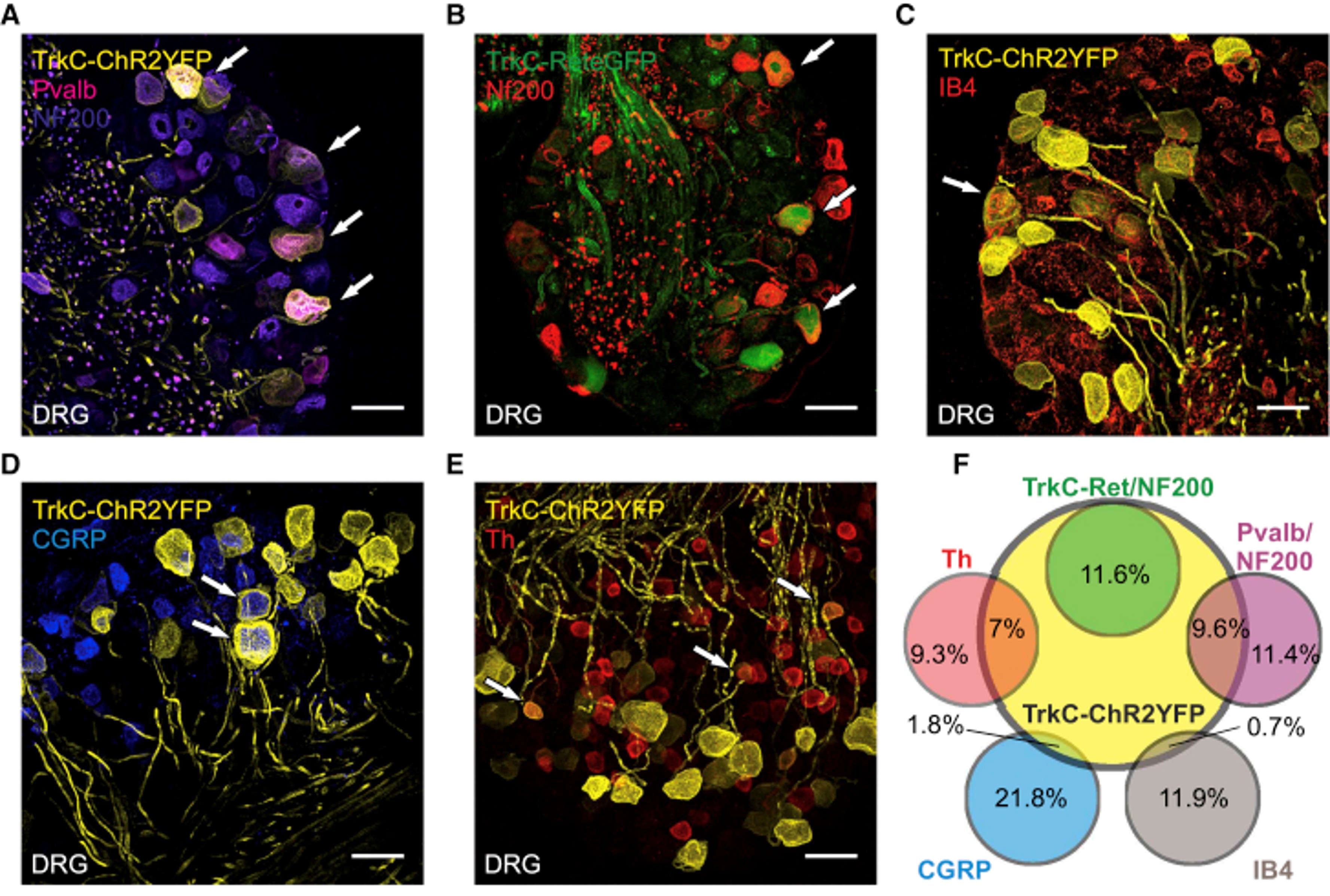 Immunofluorescence using CGRP