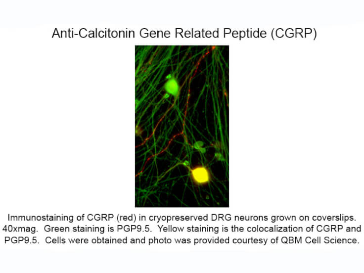 Immunocytochemistry of Anti-Calcitonin Gene Related Peptide (CGRP) (Mouse) Antibody - 200-301-D15