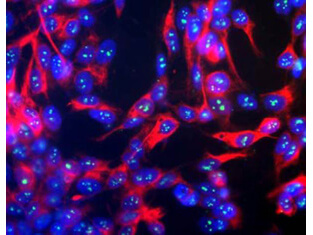Immunofluorescence of Anti-Fibrillarin (Mouse) Antibody