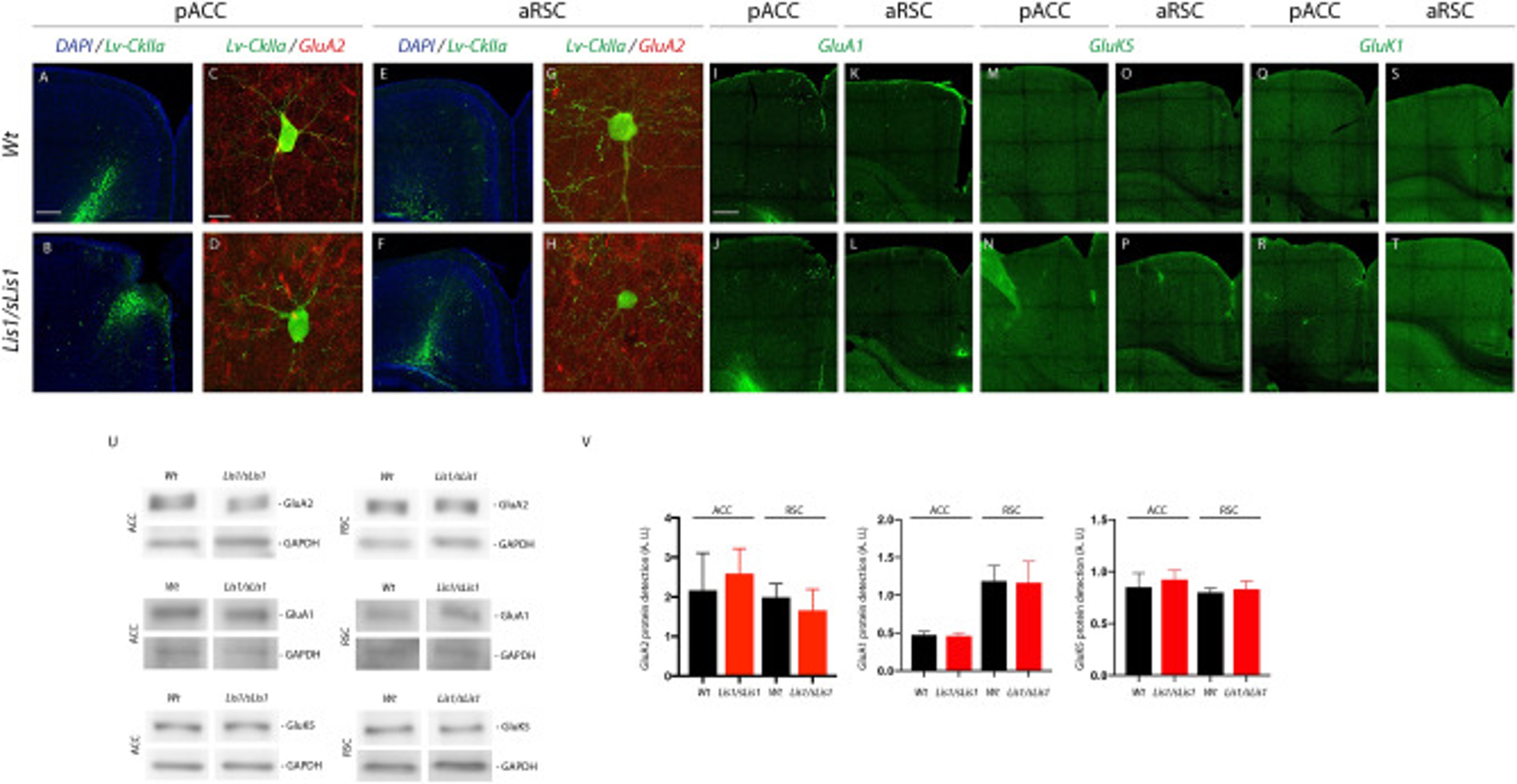 Immunofluorescence using GluR1
