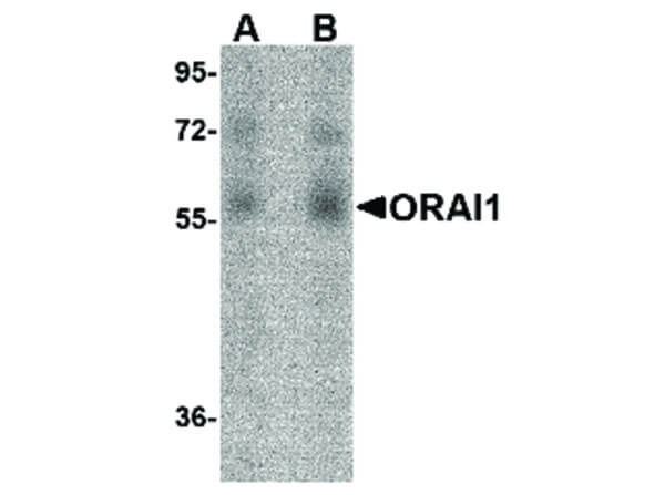 Western Blot of ORAI1 Antibody