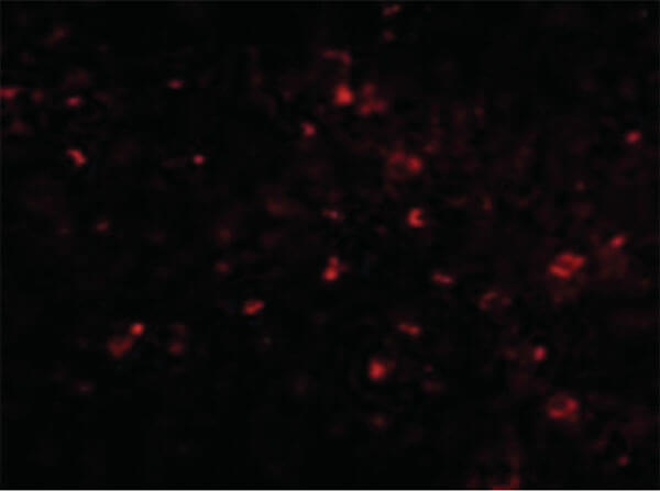 Immunofluorescence of ORAI1 Antibody