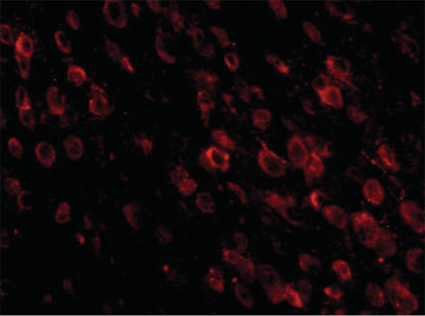 Immunofluorescence of PD-1 Antibody
