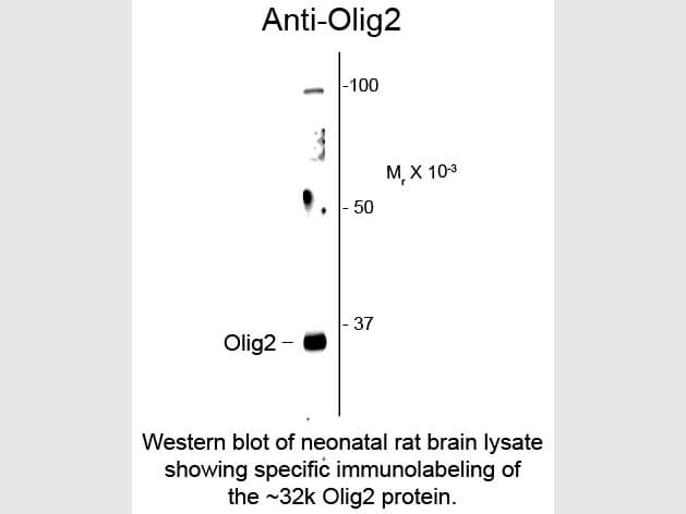 Western blot of Anti-Olig2 (Rabbit) Antibody - 200-401-E03